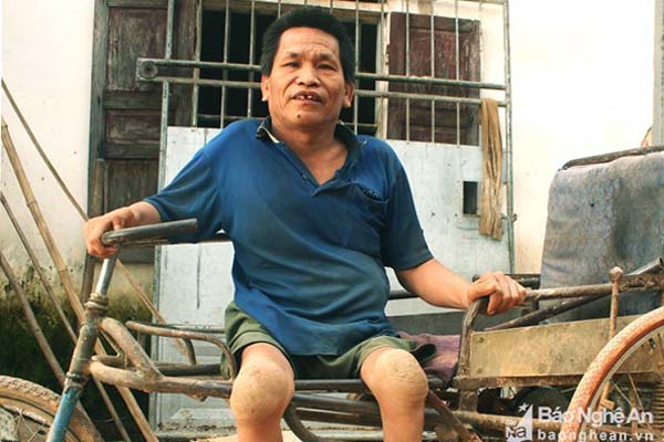 Người đàn ông đứng trên “đôi tay vàng”